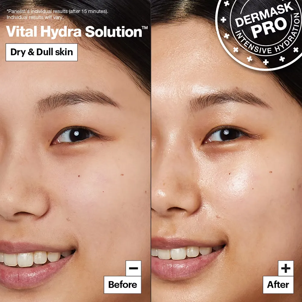 Hydra 3.webp
